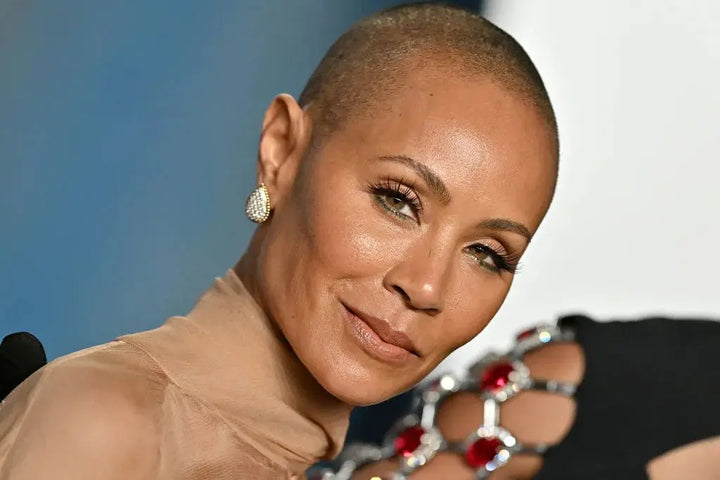 jada pinkett smith, alopecia, textured hair, curly hair